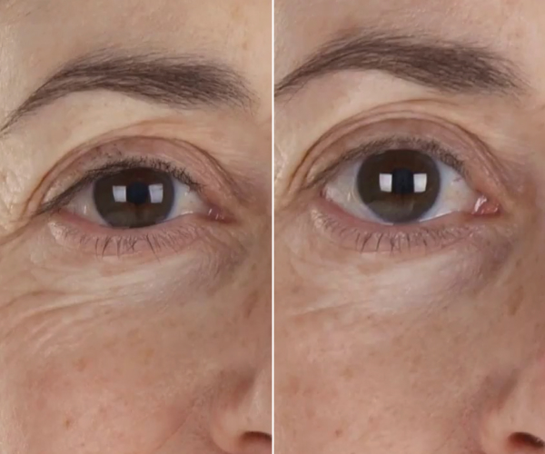 antes-x-depois-11.jpg