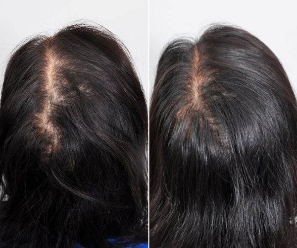 antes-x-depois-3.jpg