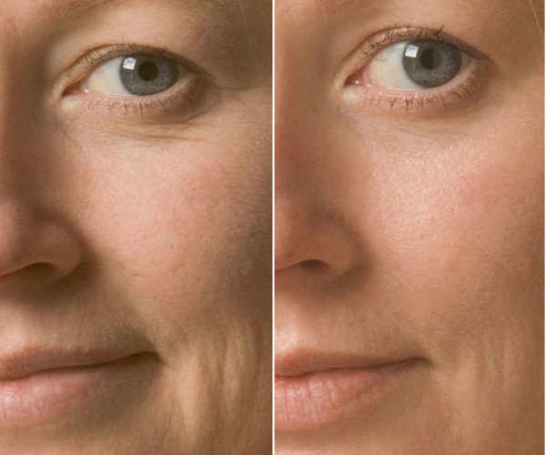 antes-x-depois-6.jpg