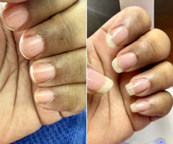 antes-x-depois-9.jpg